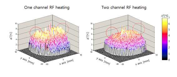 인체 모방 팬텀을 24분 동안 한 방향으로 고주파 가열(One channel RF heating)을 한 것과 두 방향으로 고주파 가열(Two channel RF heating)을 한 것의 3D 온도 분포