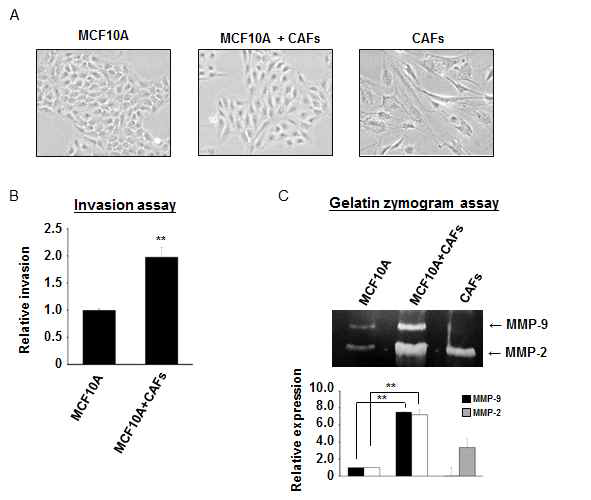 (A) 유방상피세포의 단독 배양 및 기질 섬유아세포와의 공동배양을 통한 세포형태 변화 관찰. (B) 유방상피세포의 단독 배양 및 기질 섬유아세포와의 공동배양을 통한 침윤성 확인. (C) 배양액에서 유방상피세 포 침윤성에 중요한 역할을 하는 세포외기질(ECM) 분해효소인 MMP-2, MMP-9 발현 변화 확인.