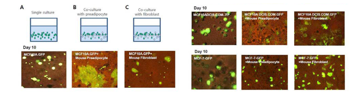 (A) GFP를 발현하는 유방세포(MCF10A.GFP)와 유방암세포(MCF10DCIS.COM.GFP 와 MCF-7.GFP)를 마트리젤에서 단독 배양 (B) 지방전구세포(preadipocyte)와 공동 배양, MCF10A 와 MCF10DCIS.COM 세포는 지방전구세포와 공동배양을 통해서 구형모양의 3차원 구조가 줄어들고 이동성이 증 가된 형태의 세포 증식을 관찰함. (C) 섬유아세포 (fibroblast)와 공동 배양, MCF10DCIS.COM 세포는 섬유아 세포와 공동배양을 통해서 구형모양의 3차원 구조가 줄어들고 이동성이 증가된 형태와 세포 증식을 관찰함.