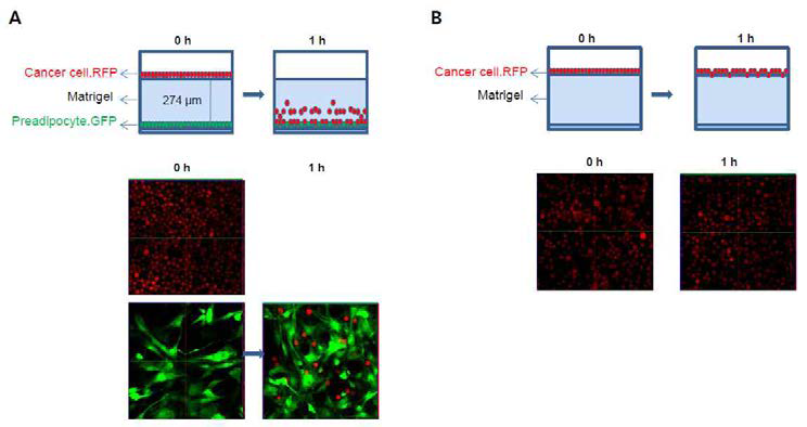 (A) 유방암세포와 지방전구세포 공동배양 (B) 유방암 세포 단독 배양. RFP를 발현하는 유방암세포 (MCF10DCIS.COM.RFP)와 GFP를 발현하는 지방전구세포를 공동배양을 통해서 유방암세포의 이동 침윤 능력 이 증가.