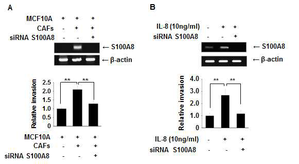 IL-8의 S100A8 발현 및 침윤능 유도 역할.