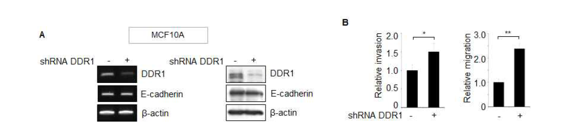 정상유방상피세포에서 DDR1의 감소가 침윤능 및 이동성에 미치는 영향.