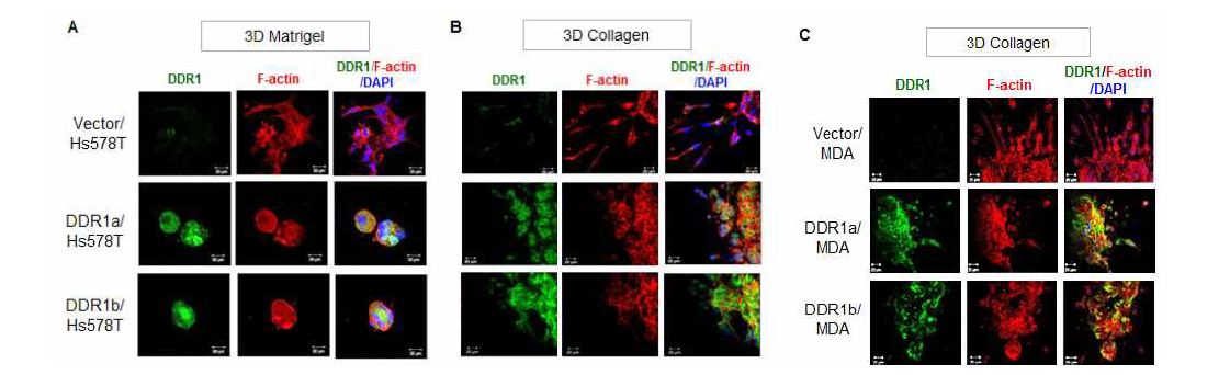 3D 세포외 기질 (매트리젤 및 콜라겐) 환경에서 DDR1이 triple-negative 유방암 세포 침윤능 억제에 미치는 영향