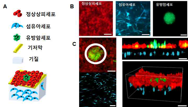 유방칩에 기질내 섬유아세포, 유선상피세포와 유방암세포(spheroid)를 공동 배양하여 초기유방암 (DCIS)을 모사함