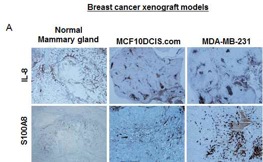 유방암 이종이식 모델에서 IL-8과 S100A8의 발현 확인