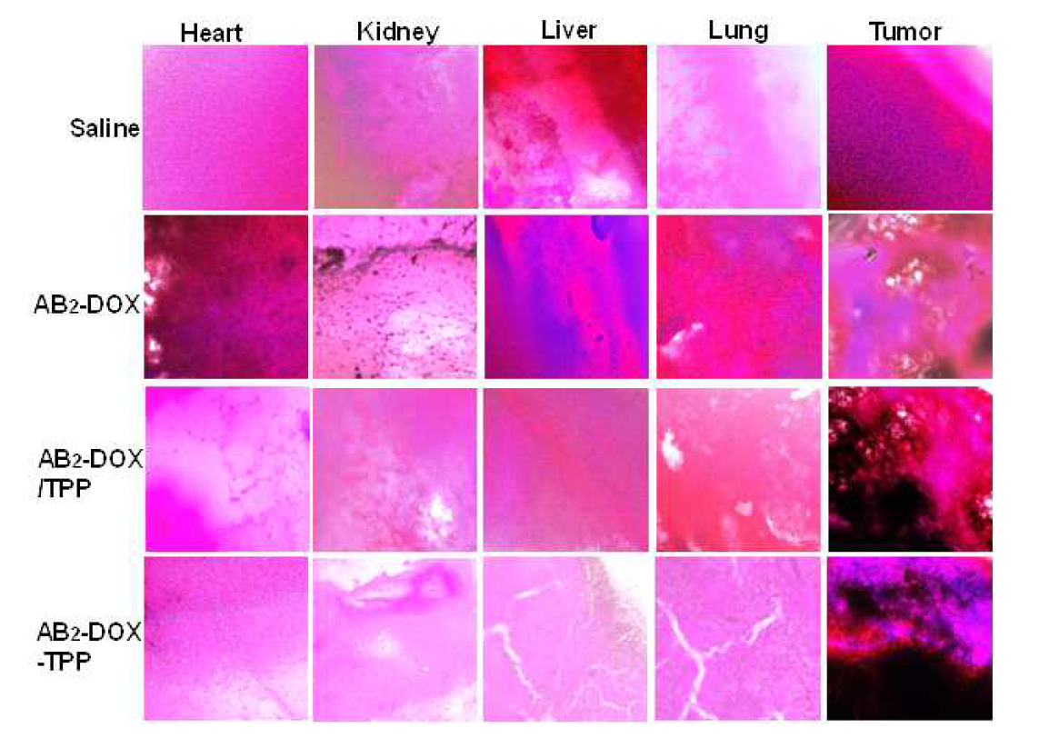 H&E staining images of tumor tissue and organs after 60 days of observation.