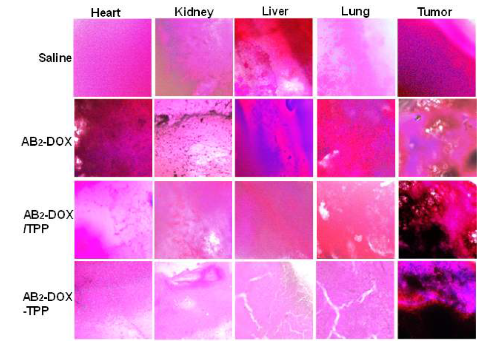 H&E staining images of tumor tissue and organs after 60 days of observation.