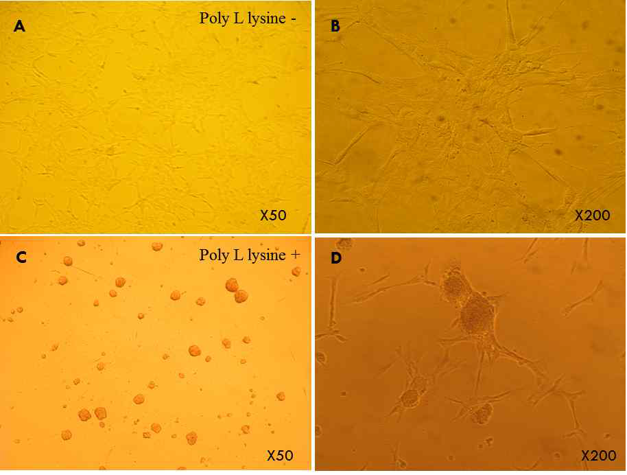 Morphological differences between poly-L lysine treated and non-treated group in cerebrum tissue culture