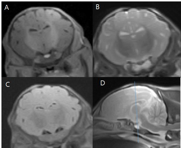 2일령 돼지의 Interthalamic adhesion에서 측정한 T1w 강조(A), T2w 강조(B), FLAIR(C), T2w sagittal(D) 영상