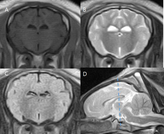 67일령 돼지의 Interthalamic adhesion에서 측정한 T1w 강조(A), T2w 강조(B), FLAIR(C), T2w sagittal(D) 영상