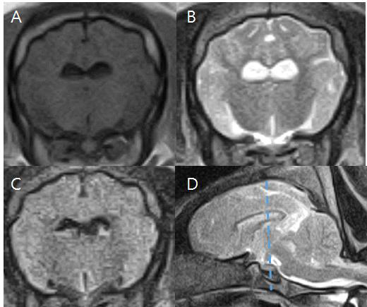 116일령 돼지의 Interthalamic adhesion에서 측정한 T1w 강조(A), T2w 강조(B), FLAIR(C), T2w sagittal(D) 영상