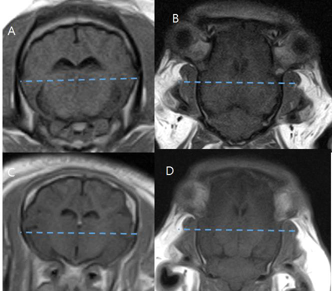 Gadolinum 0.2ml/kg IV 주입 후 T1w 강조 67일령 Transverse(A), Dorsal(B), 116일령 Transverse(C), Dorsal(D) 영상