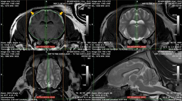 Total brain을 세방향(transverse, dorsal, sagittal)에서 tracing하는 과정의 한 단면