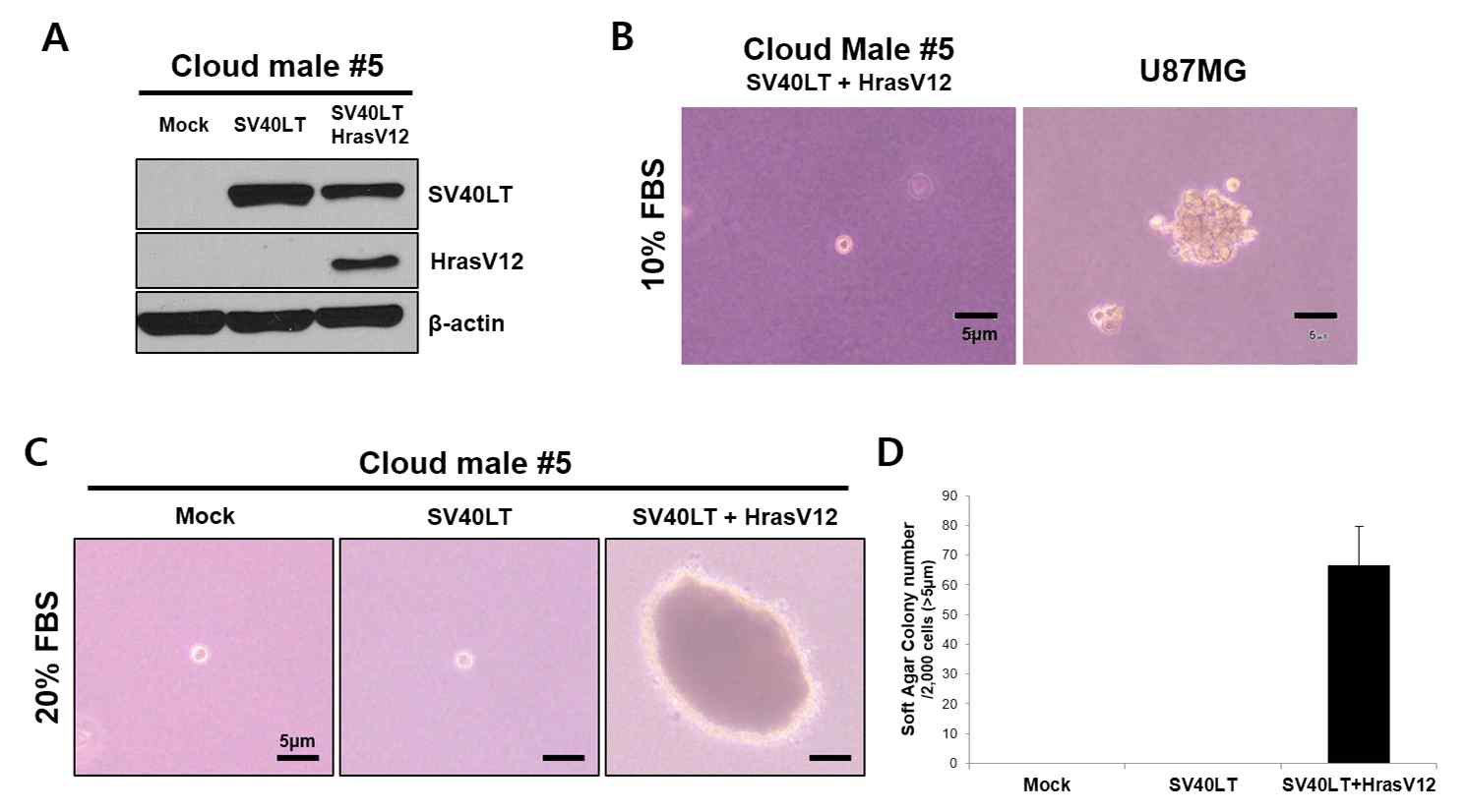 Anchorage independent growth was not detected in yucatan fibroblast overexpressed HrasV12.