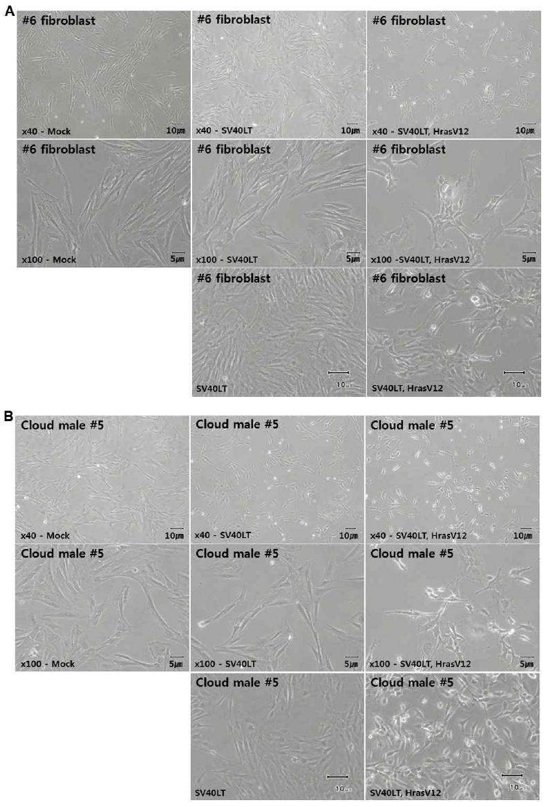 Morphological changes of miniature pig fibroblast lines via an overexpression of SV40LT and HRasV12 A), B)