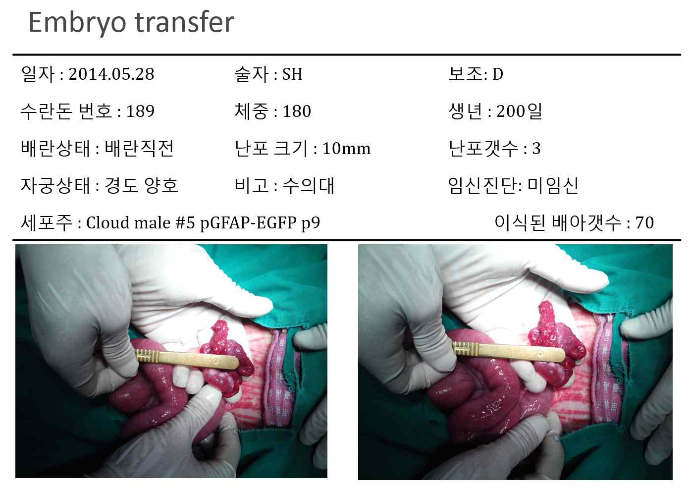 Result of Embryo transfer and surrogate ovary images