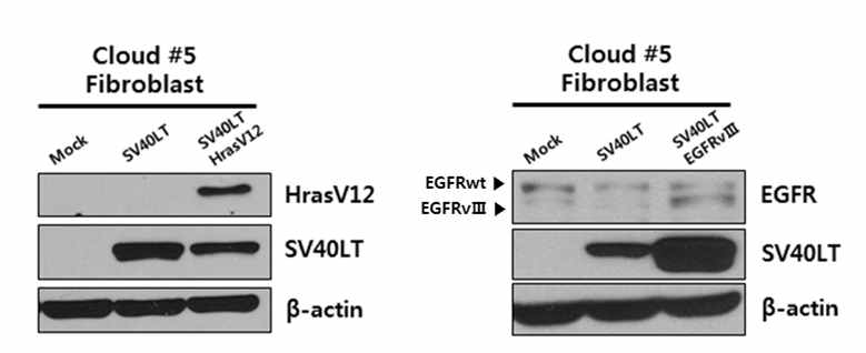 An overexpression of brain tumor inducing oncogenes, EGFRvⅢ, HRasV12, and SV40LT, was confirmed by western blotting.