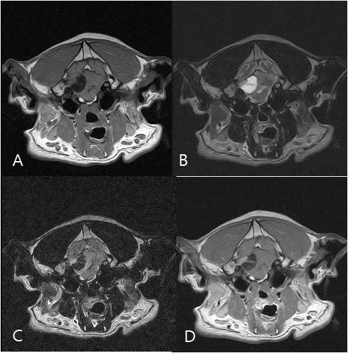 팡 MRI영상 T1강조(A), T2강조(B), FLAIR(C), T1강조조영증강(D)