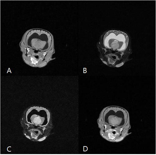 쫄랑 MRI영상 T1강조(A), T2강조(B), FLAIR(C), T1강조조영증강(D)