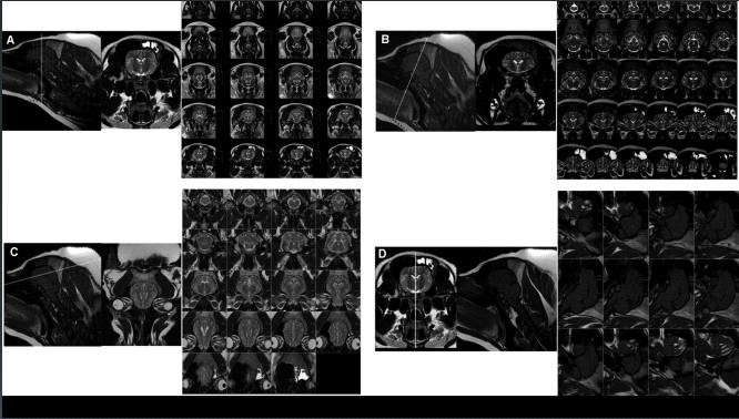 MRI영상으로 획득한 3가지 다른 방향의 tomogram 영상