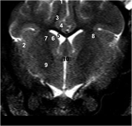 T2w axial이미지에서 해부학적 랜드마크와 해당 명칭