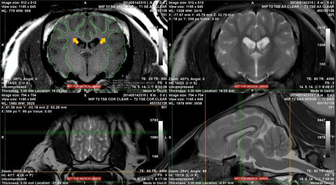 Grey matter을 세 방향(transverse, dorsal, sagittal)에서 tracing하는 과정의 한 단면