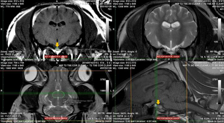 Hypophysis을 세 방향(transverse, dorsal, sagittal)에서 tracing하는 과정의 한 단면