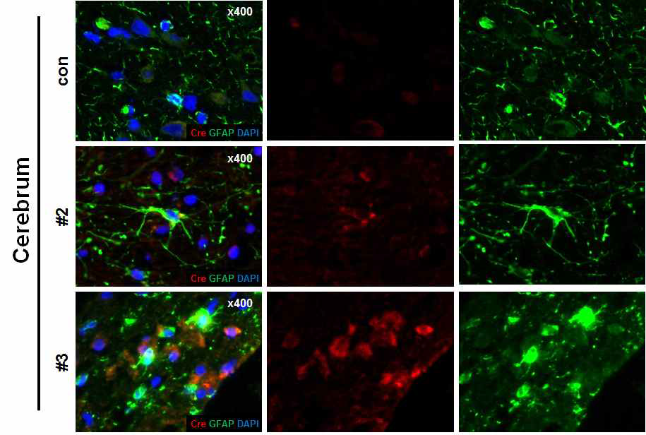 CreERT2-Transgene expression in cerebrum tissue of transgenic pig with astrocyte-specific CreERT2-LoxP recombination system.