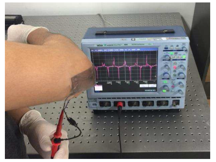 압전 폴리머를 실제 피부에 부착하여 출력전압을 관찰