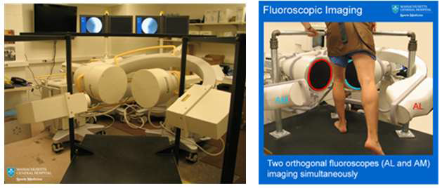 미국 하버드 대학의 두 방향 엑스선 영상 시스템