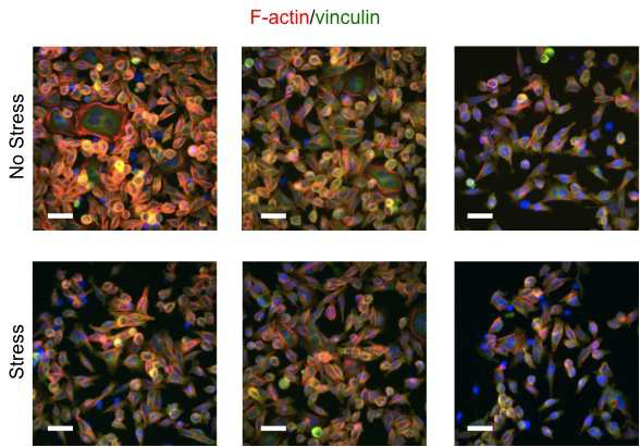 F-actin과 vinculin 마커를 이용하여 세포의 골격 및 부착 확인