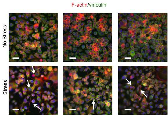 F-actin과 vinculin 마커를 이용하여 세포의 골격 및 부착 확인