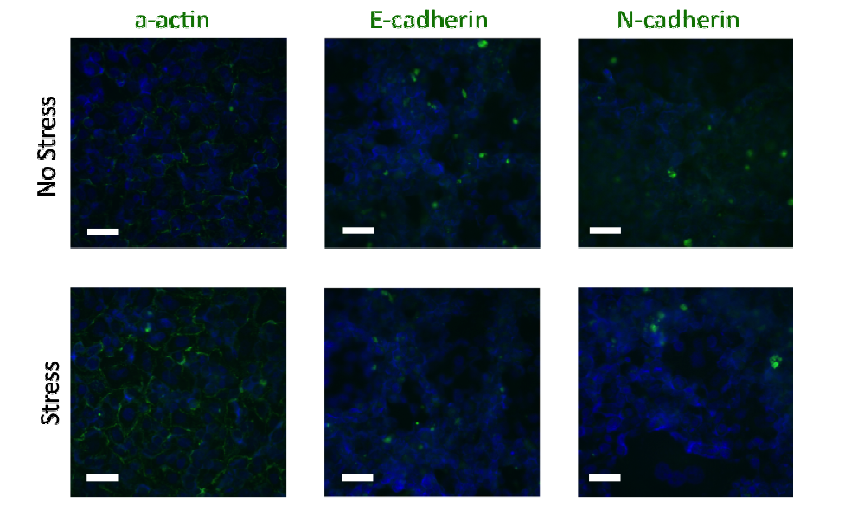 세포 골격 마커인 a-actin과 세포와 세포간 결합을 나타내는 마커인 N-cadherin, E-cadherin 발현차이 확인