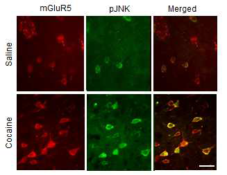 코카인을 반복적으로 투여한 쥐의 선조체에서는 mGluR5의 발현이 대조군에 비해 증가(왼쪽 붉은색)하였고 JNK의 인산화(가운데, 녹색) 또한 현저히 증가하였다. 이들 단백질들은 동일한 뉴런에서 발현되는 것으로 나타났다