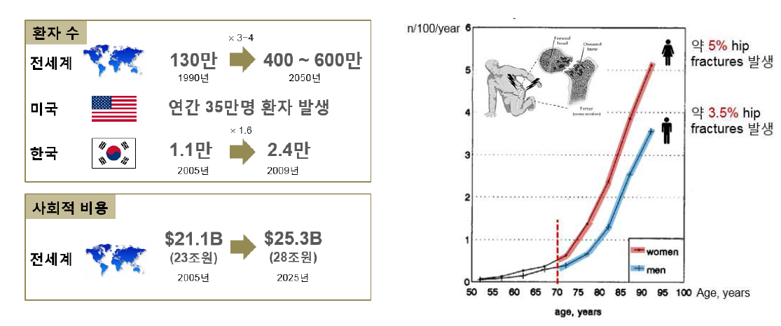 고관절 골절 환자 추이 및 실태