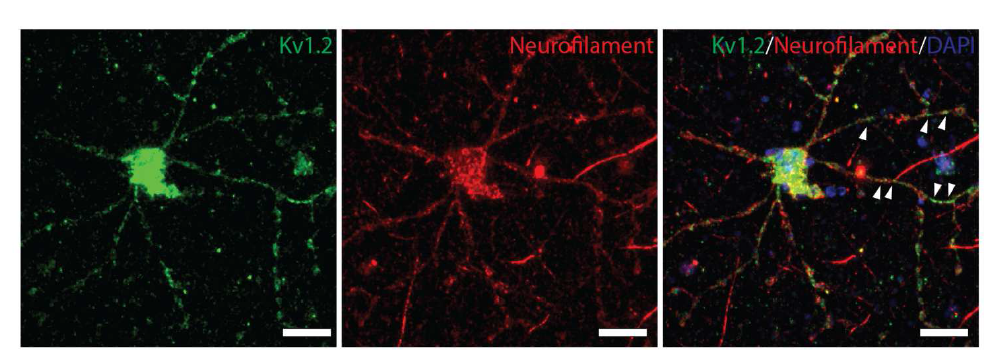 공동배양 정교화를 통한 조직의 개선. 공동배양 환경의 정교화를 통해서 myelin된 axon에서 발현되는 이온채널을 형광 염색을 통해 확인함. axon과 분화된 NSC가 상호작용해 형성된 조직을 형광염색을 통해 확인함