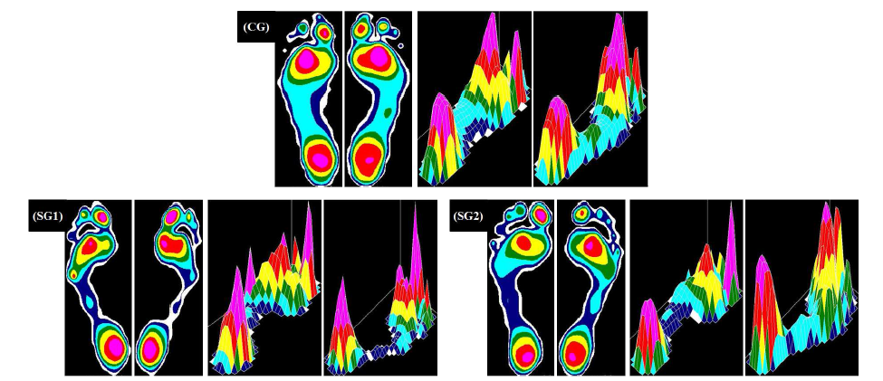 Differences in plantar and body pressure distributions between the groups