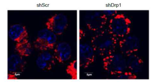 Confocal microscope 를 이용한 Drp1 발현 억제세포의 미토콘드리아 elongation