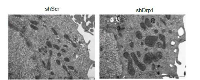 전자현미경을 이용한 Drp1 발현 억제세포의 미토콘드리아 융합