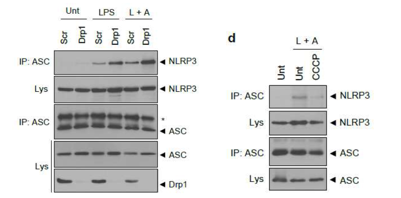 NLRP3-ASC 분자적 결합에 대한 미토콘드리아 다이나믹스의 영향