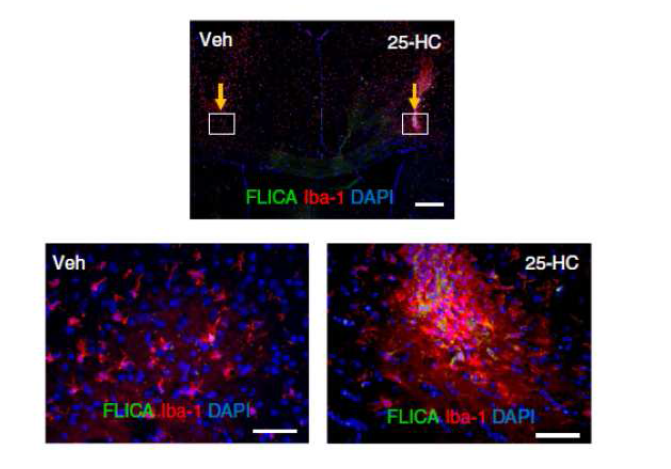 25-HC 의 마우스 대뇌 정위주사에 의한 active caspase-1 확인