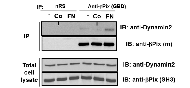 Fibronectin(FN)-특이적인 Dynamin과ßPix의 상호작용