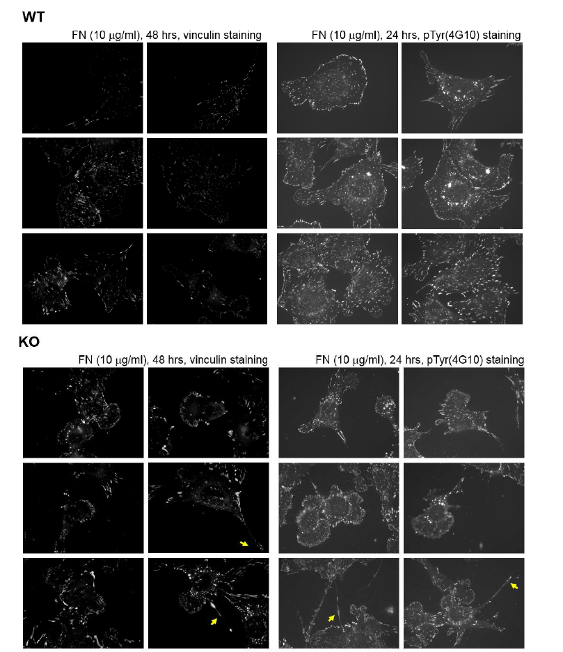 ßPix-null MEF에서는 세포 뒤쪽 focal adhesion의 turnover가 잘 되지 않아 꼬리 모양의 구조가 남아 있는 tailing 현상이 관찰됨