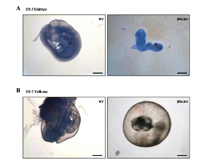 ßPix KO mouse embryo에서 정상적인 혈관 발생이 저해되어 있음