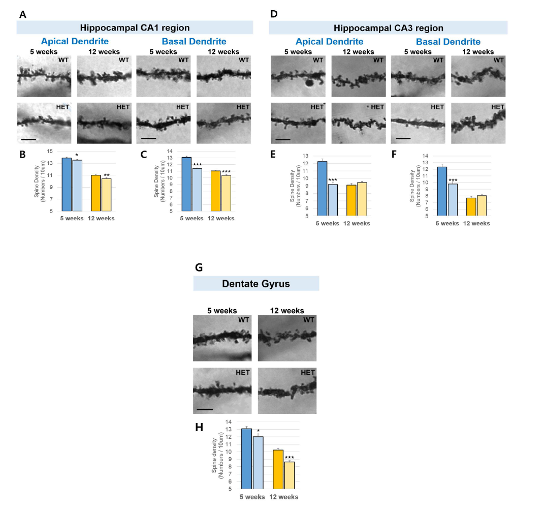 5주령ßPix heterozygous mouse의 해마 신경세포에서 dendritic spine density의 감소