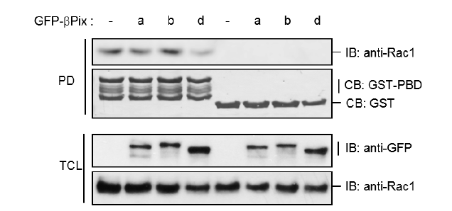 ßPix-d는 Rac1활성화를 감소시킴