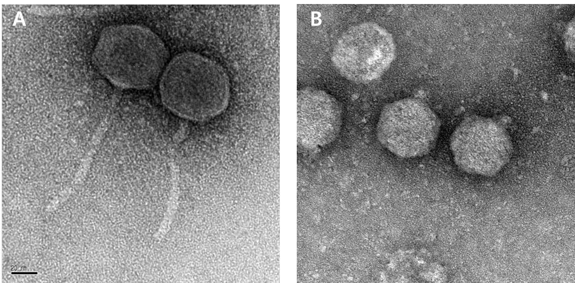 P26059A 와 P26059B 파지의 morphogology 관찰 결과.