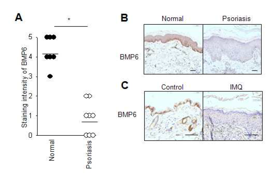 정상 피부 조직과 건선 환자의 피부조직에서의 BMP6 발현 비교 및 건선 유발 마우스 피부 조직에서의 BMP6 발현 비교