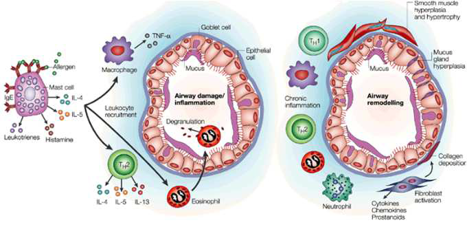 알레르기성 천식의 반응 기전