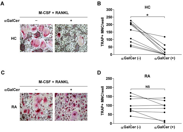 in vitro 파골세포 분화에서 αGalCer의 역할 분석